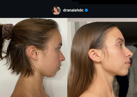 Jaw Dysfunction and Neuro-Sensitive Dysautonomia